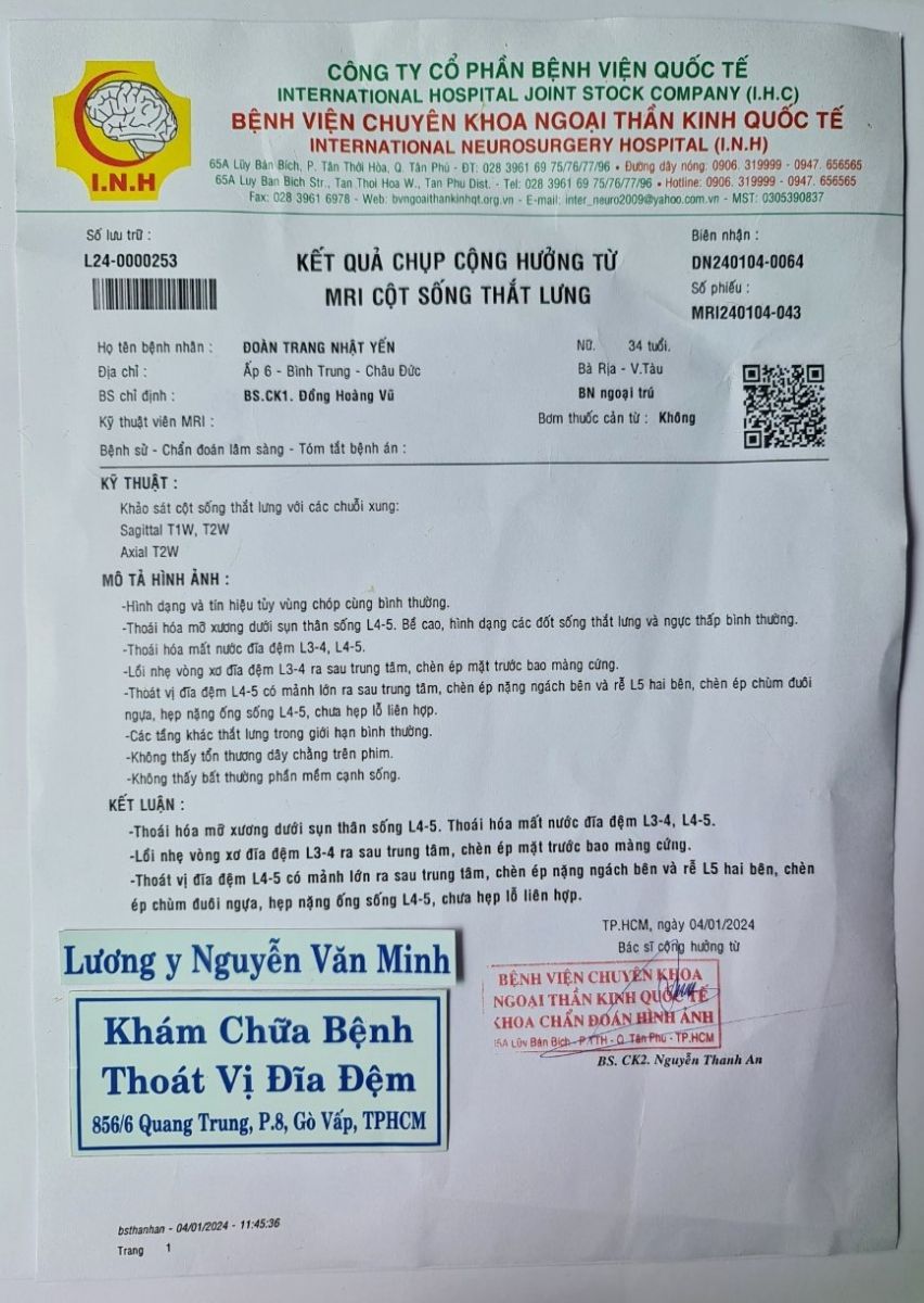 Thoát vị đĩa đệm L4 L5